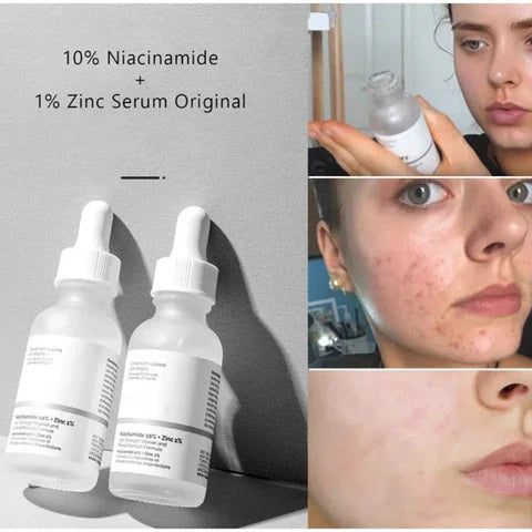 The Ordinary Niacinamide 10% + Zinc 1% Serum (30ml) with Free Niacinamide Face Wash